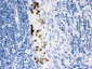 Anti-Cardiac FABP Antibody